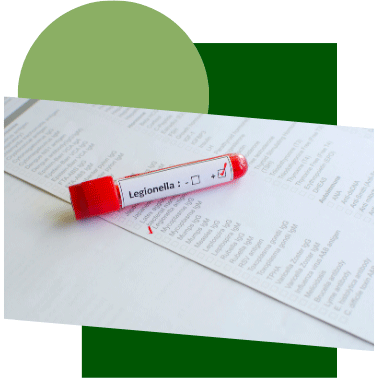 Análisis de Legionella